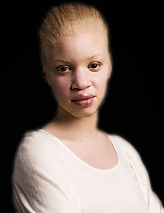 femme-albinos